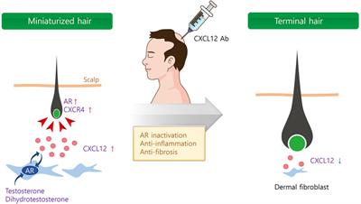 Recent approaches of antibody therapeutics in androgenetic alopecia